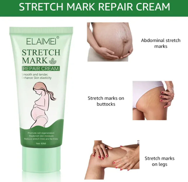 Stretch Mark Repair Cream